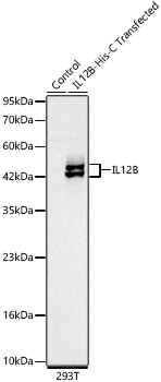 IL12B Rabbit monoclonal antibody