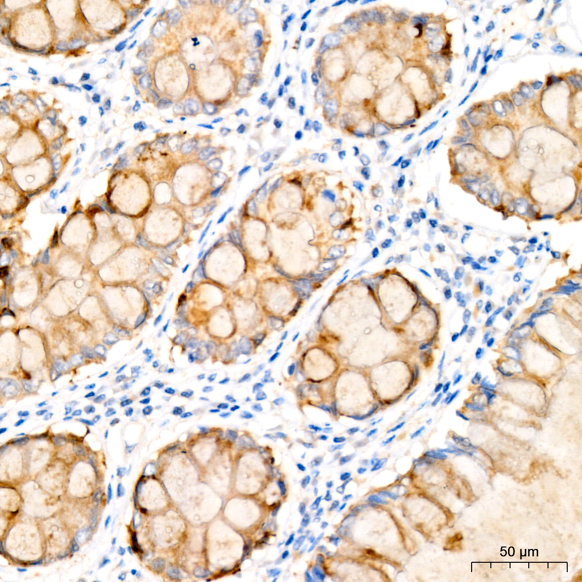 IL12B Rabbit monoclonal antibody