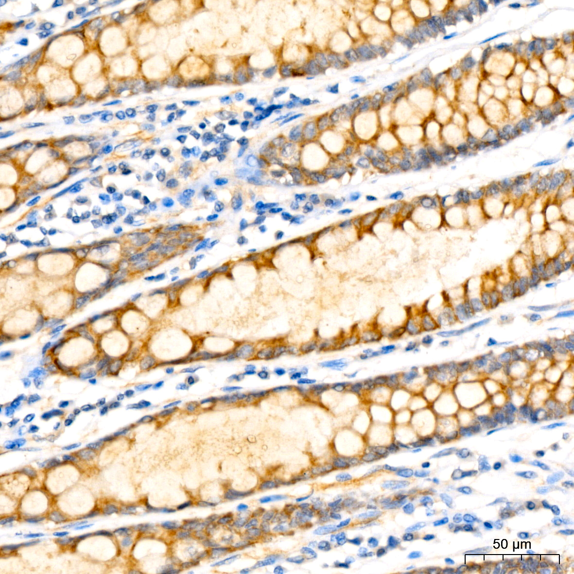 IL12B Rabbit monoclonal antibody