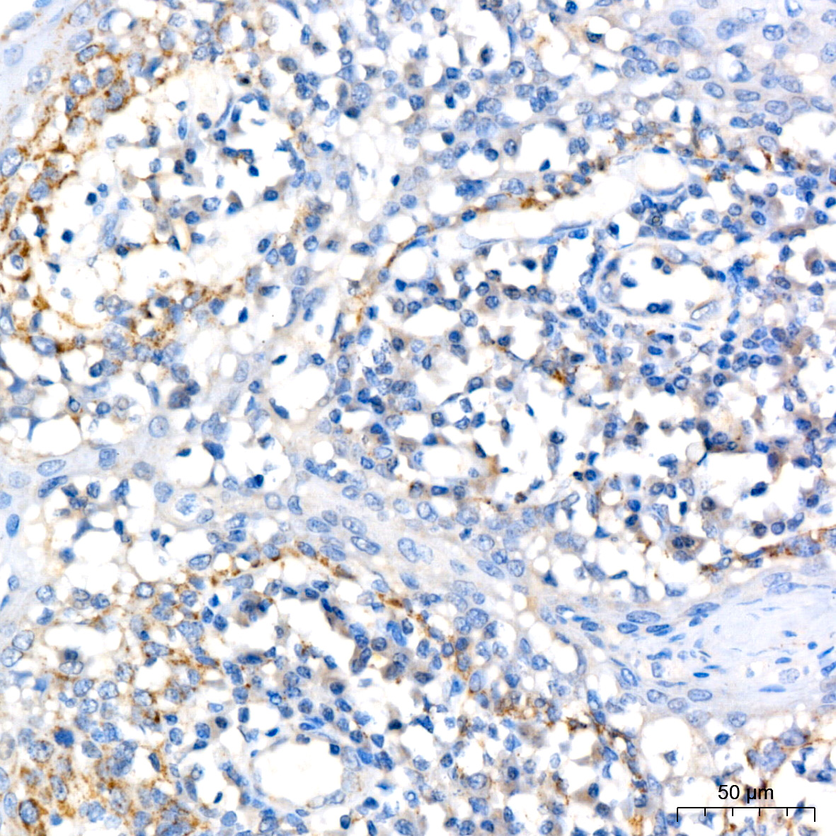 IL12B Rabbit monoclonal antibody