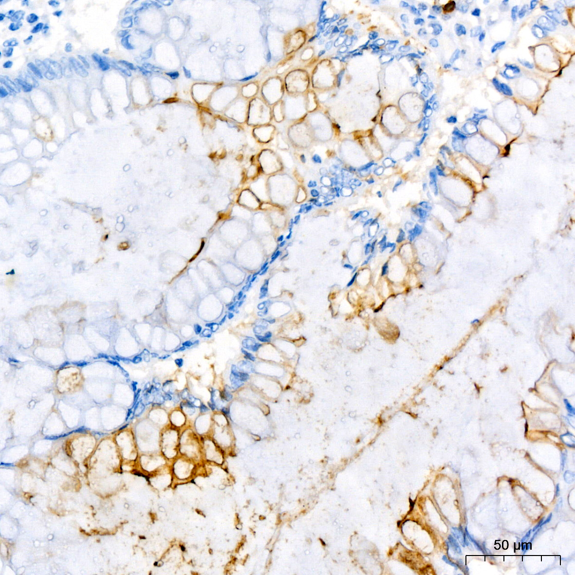 CD177 Rabbit monoclonal antibody