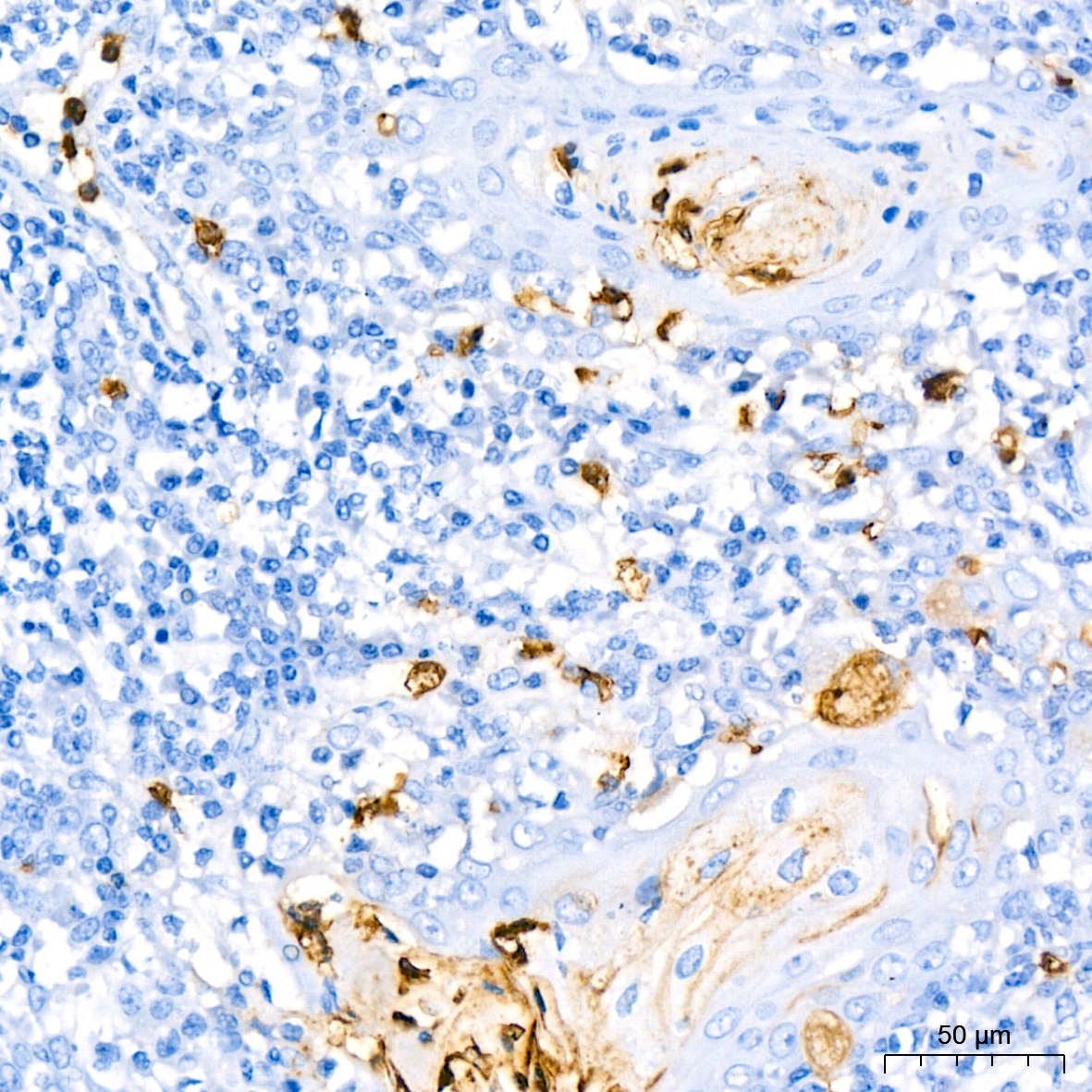 CD177 Rabbit monoclonal antibody