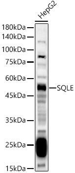 SQLE Rabbit polyclonal antibody