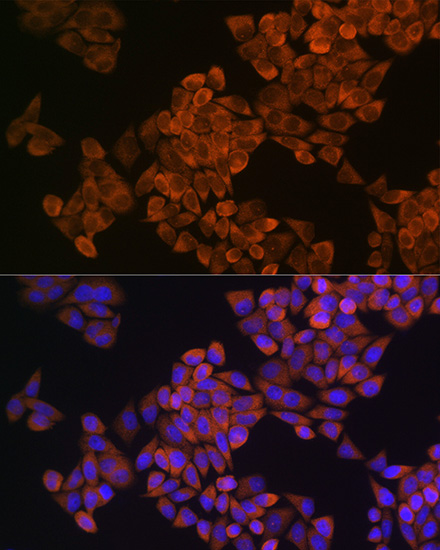 SQLE Rabbit polyclonal antibody