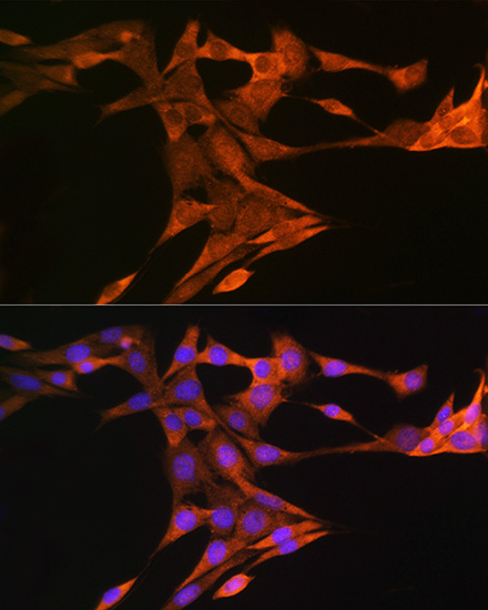 SQLE Rabbit polyclonal antibody