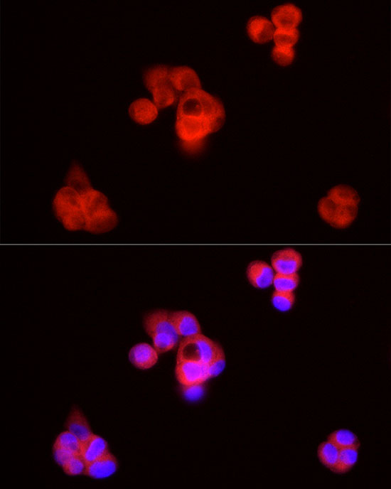 SQLE Rabbit polyclonal antibody