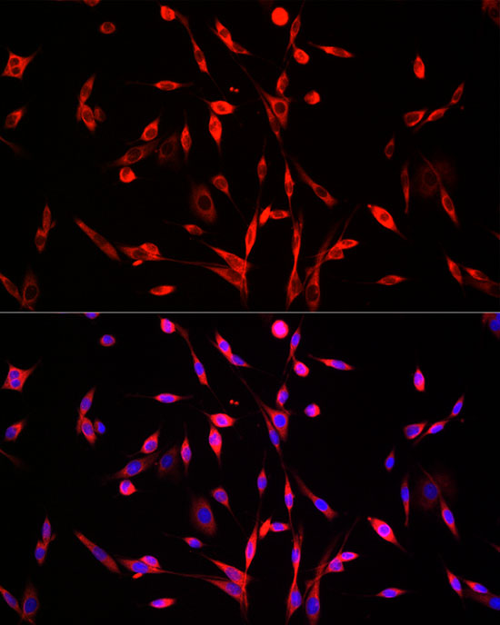 SQLE Rabbit polyclonal antibody