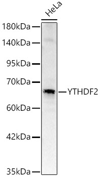 YTHDF2 Rabbit polyclonal antibody