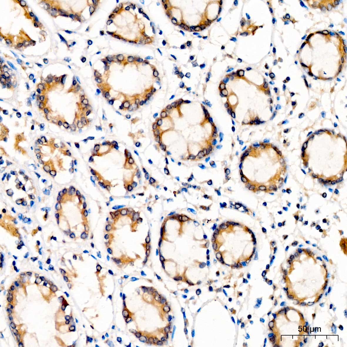 YTHDF2 Rabbit polyclonal antibody