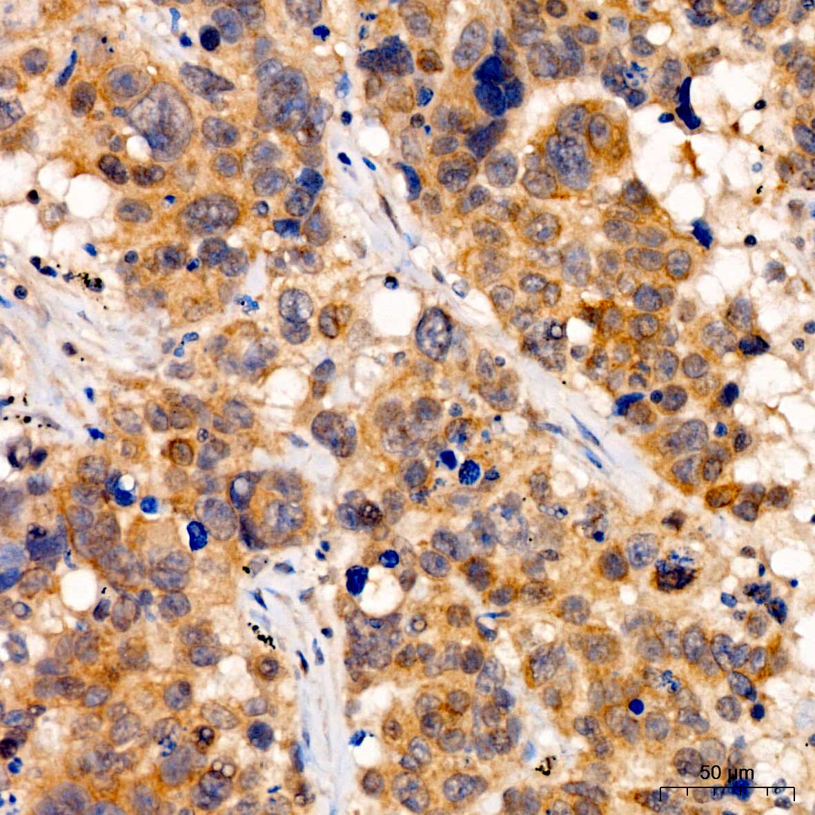 YTHDF2 Rabbit polyclonal antibody