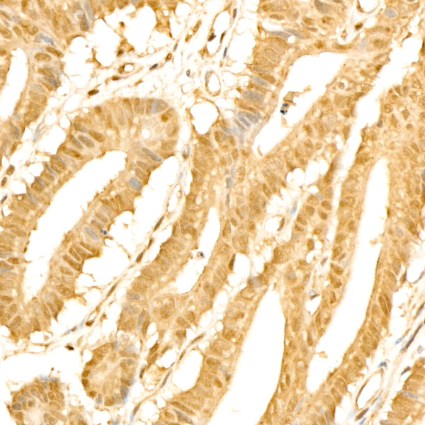 PPP1CA Rabbit monoclonal antibody