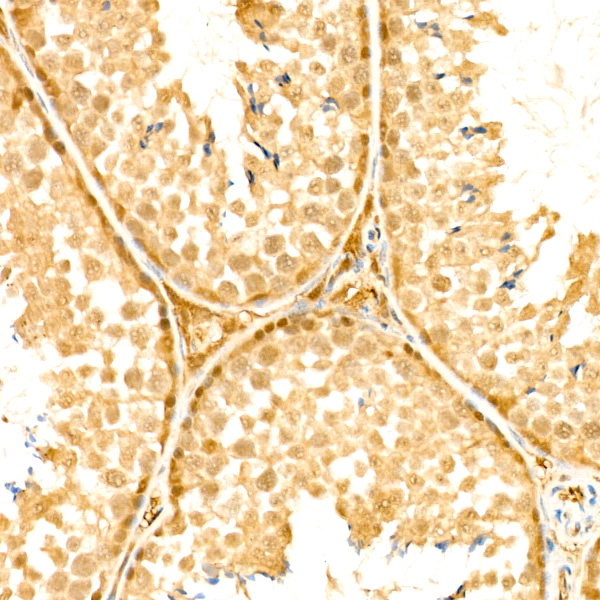 PPP1CA Rabbit monoclonal antibody