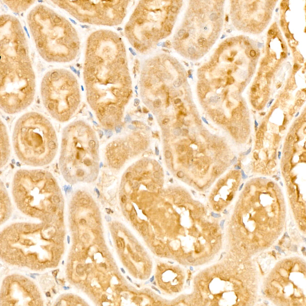 PPP1CA Rabbit monoclonal antibody