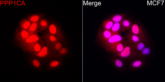PPP1CA Rabbit monoclonal antibody