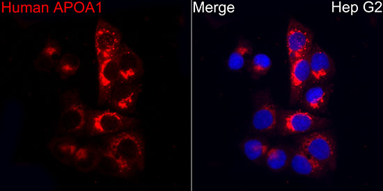 Apolipoprotein A1/APOA1 Rabbit monoclonal antibody