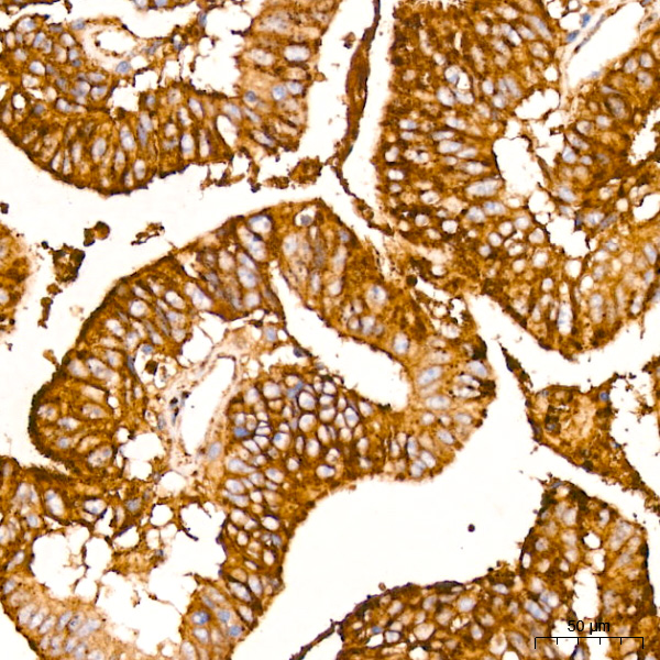 IFITM3 Rabbit monoclonal antibody