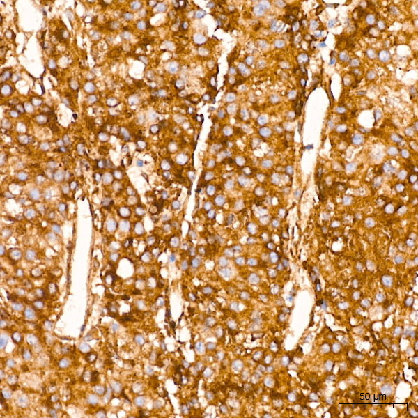 IFITM3 Rabbit monoclonal antibody