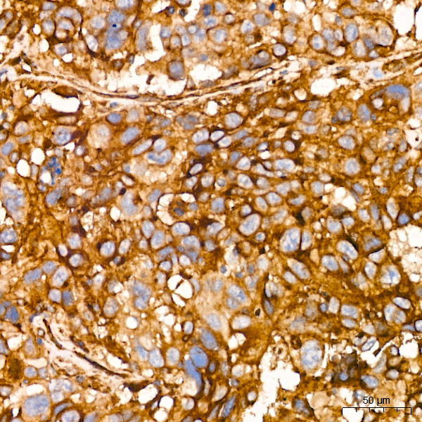 IFITM3 Rabbit monoclonal antibody