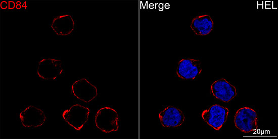CD84 Rabbit monoclonal antibody