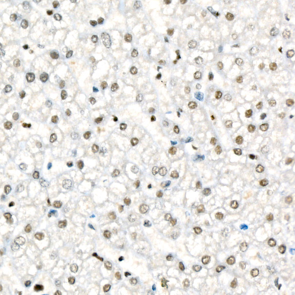 Fos B Rabbit monoclonal antibody