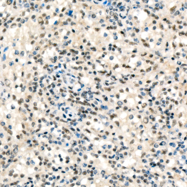 Fos B Rabbit monoclonal antibody