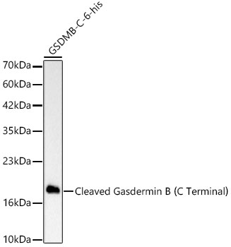 Cleaved Gasdermin B (C Terminal) Rabbit monoclonal antibody
