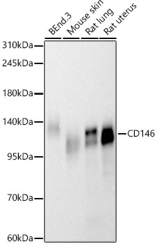 CD146 Rabbit monoclonal antibody