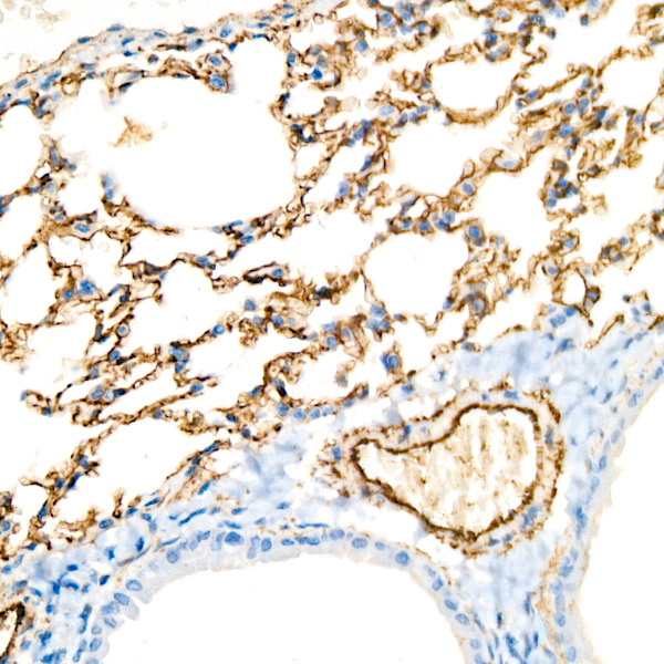 CD146 Rabbit monoclonal antibody