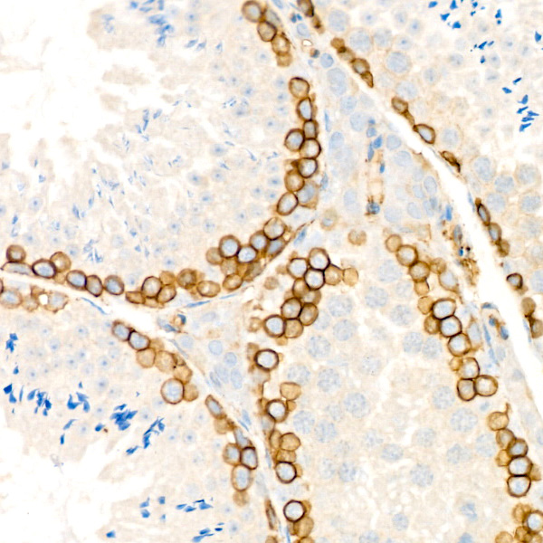 CD146 Rabbit monoclonal antibody
