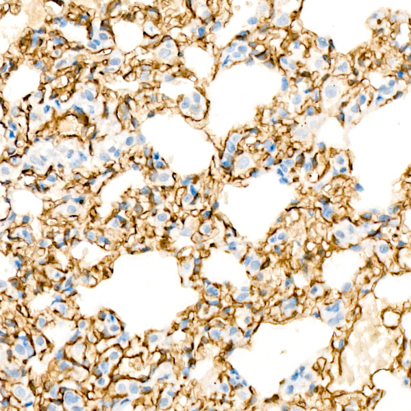 CD146 Rabbit monoclonal antibody