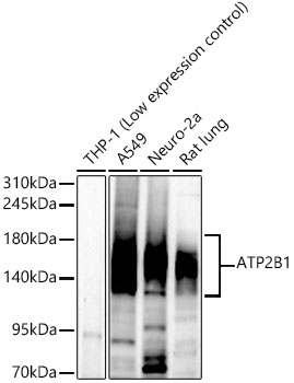 ATP2B1 Rabbit monoclonal antibody