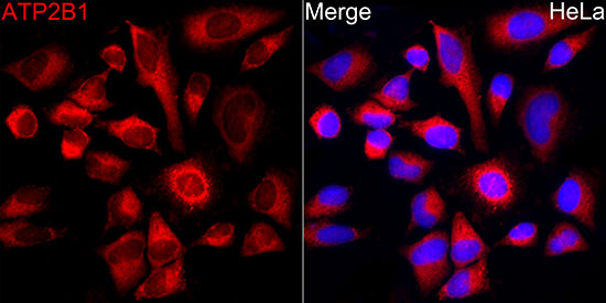 ATP2B1 Rabbit monoclonal antibody