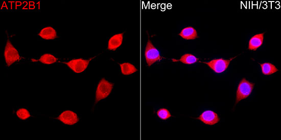ATP2B1 Rabbit monoclonal antibody