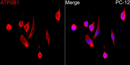 ATP2B1 Rabbit monoclonal antibody
