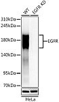 Western blot - [KD Validated] EGFR Rabbit PolymAb® (A24388)