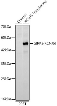 GIRK2(KCNJ6) Rabbit monoclonal antibody