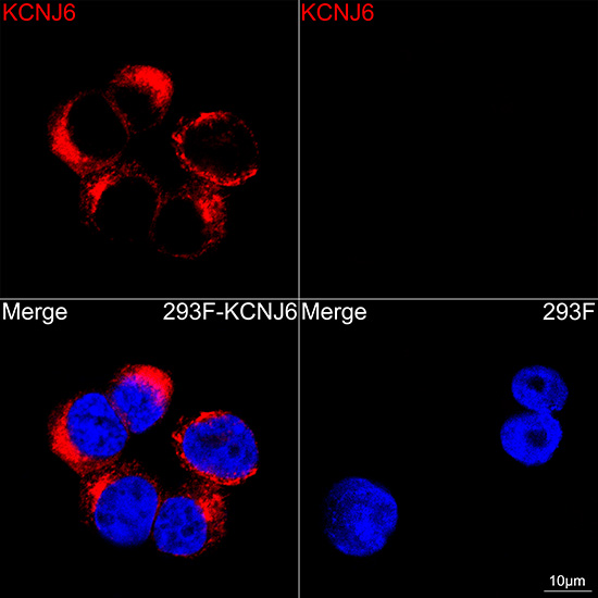 GIRK2(KCNJ6) Rabbit monoclonal antibody