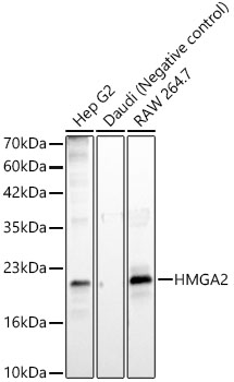 HMGA2 Rabbit monoclonal antibody