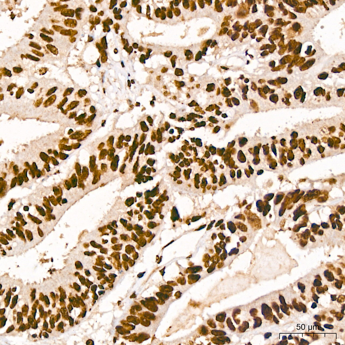 HMGA2 Rabbit monoclonal antibody