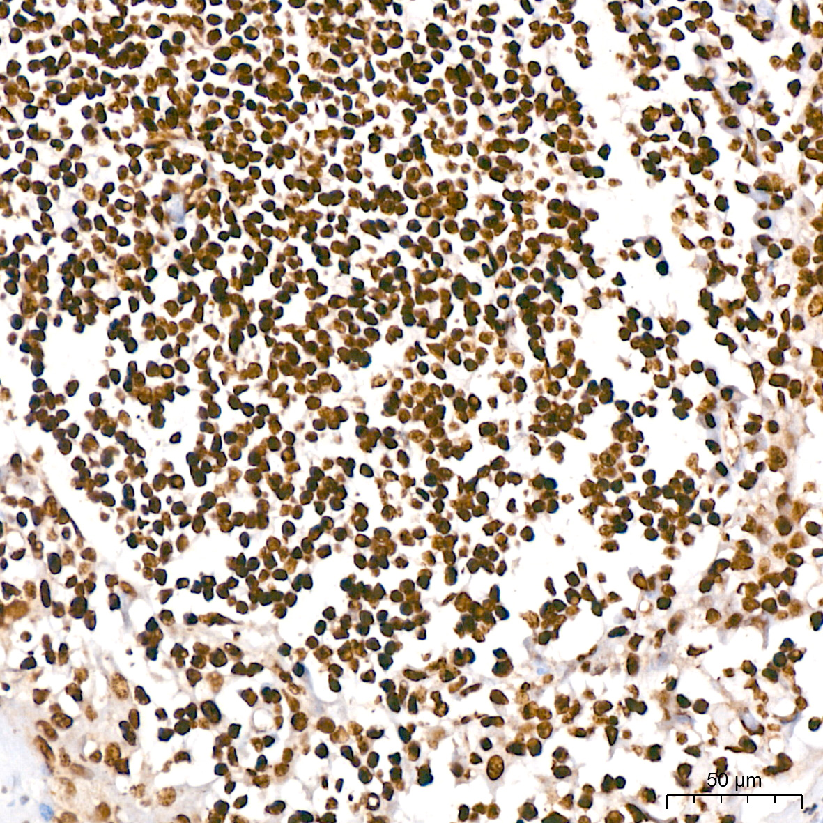 HMGA2 Rabbit monoclonal antibody