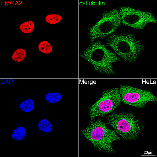 HMGA2 Rabbit monoclonal antibody