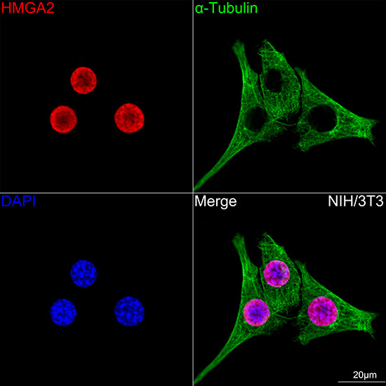 HMGA2 Rabbit monoclonal antibody
