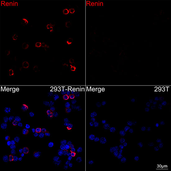 Renin Rabbit monoclonal antibody