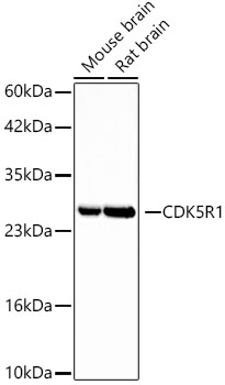 CDK5R1 Rabbit monoclonal antibody
