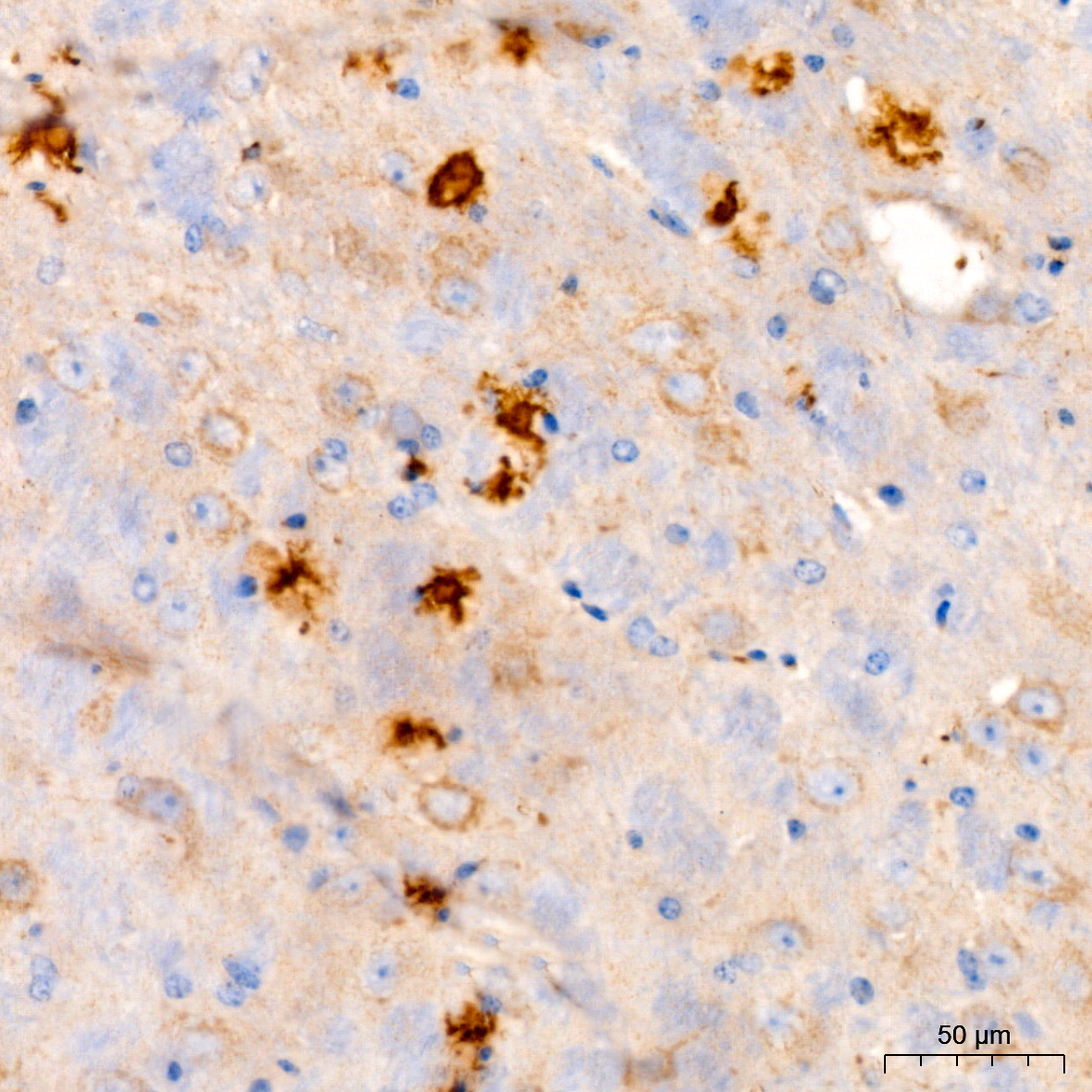 B Beta-Amyloid(1-42) Rabbit monoclonal antibody