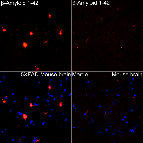 B Beta-Amyloid(1-42) Rabbit monoclonal antibody