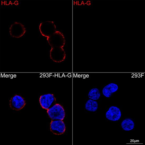PAH (G9) Rabbit mAb