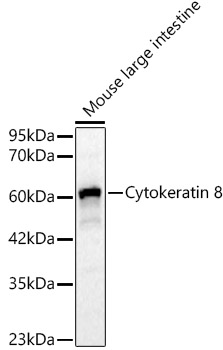[KO Validated] Cytokeratin 8 Rabbit polyclonal antibody