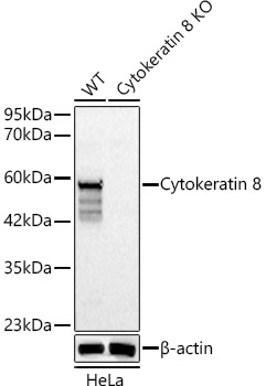 [KO Validated] Cytokeratin 8 Rabbit polyclonal antibody