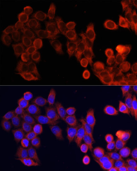 mTOR Rabbit polyclonal antibody